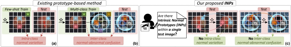 INP 动机：外部 prototype 可能不对齐，图像内部 normal prototype 更贴近当前测试图